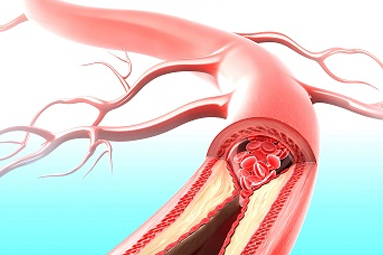 Peripheral Vascular Clinic